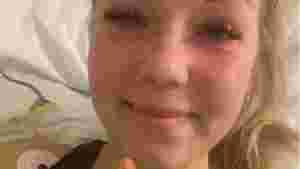 - Jeg beholdt kneet og livet og er glad for det